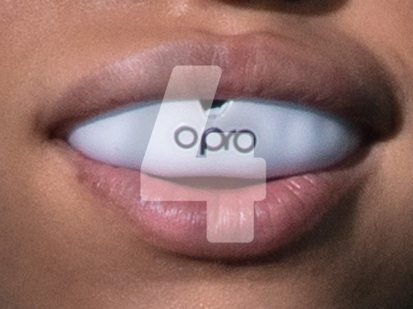 Fitting Mouthguard With Braces